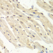 PSME1 Antibody - Immunohistochemistry of paraffin-embedded mouse heart.