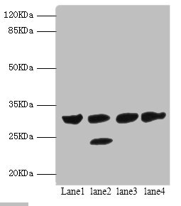 PSME1 Antibody - Western blot All Lanes:PSME1 antibody at 1.4ug/ml Lane 1:mouse liver tissue Lane 2:mouse thymus tissue Lane 3:Raji whole cell lysate Lane 4:HL-60 whole cell lysate Secondary Goat polyclonal to rabbit at 1/10000 dilution Predicted band size: 29,27 kDa Observed band size: 29 kDa,25 kDa