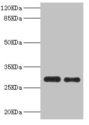 PSME1 Antibody - Western blot All lanes: PSME1 antibody at 0.75µg/ml Lane 1: Mouse liver tissue Lane 2: Raji whole cell lysate Secondary Goat polyclonal to rabbit IgG at 1/10000 dilution Predicted band size: 29, 27 kDa Observed band size: 29 kDa