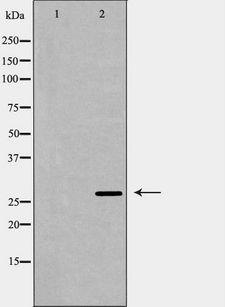 PSME1 Antibody - Western blot analysis of mouse liver tissue lysates using PSME1 antibody. The lane on the left is treated with the antigen-specific peptide.