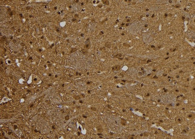 PSME1 Antibody - 1:100 staining rat brain tissue by IHC-P. The sample was formaldehyde fixed and a heat mediated antigen retrieval step in citrate buffer was performed. The sample was then blocked and incubated with the antibody for 1.5 hours at 22°C. An HRP conjugated goat anti-rabbit antibody was used as the secondary.