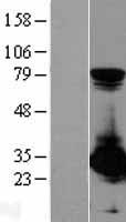 PSME1 Protein - Western validation with an anti-DDK antibody * L: Control HEK293 lysate R: Over-expression lysate