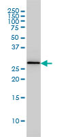 PSME2 Antibody - PSME2 monoclonal antibody (M02), clone 1G4 Western blot of PSME2 expression in MCF-7.