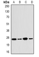 PSME2 Antibody - Western blot analysis of PA28 beta expression in SW480 (A); HepG2 (B); mouse liver (C); mouse lung (D) whole cell lysates.