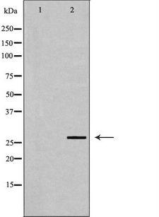 PSME2 Antibody - Western blot analysis of HepG2 whole cells lysates using PSME2 antibody. The lane on the left is treated with the antigen-specific peptide.