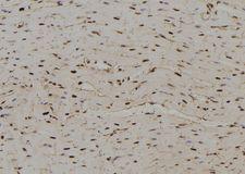 PSME2 Antibody - 1:100 staining rat heart tissue by IHC-P. The sample was formaldehyde fixed and a heat mediated antigen retrieval step in citrate buffer was performed. The sample was then blocked and incubated with the antibody for 1.5 hours at 22°C. An HRP conjugated goat anti-rabbit antibody was used as the secondary.