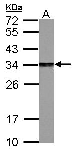 PSME3 Antibody - Sample (30 ug of whole cell lysate). A: PC-12. 12% SDS PAGE. PSME3 antibody diluted at 1:2000.