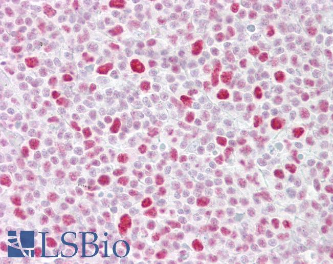 PSME3 Antibody - Anti-PSME3 antibody IHC of human tonsil. Immunohistochemistry of formalin-fixed, paraffin-embedded tissue after heat-induced antigen retrieval. Antibody concentration 5 ug/ml.  This image was taken for the unconjugated form of this product. Other forms have not been tested.