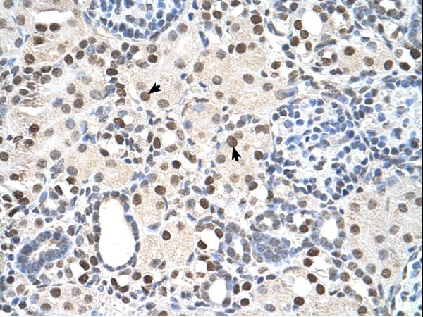 PSME3 Antibody - Paraffin embedded tissue: Human Kidney. Cells with positive label: Epithelial cells of renal tubule (indicated with arrows). Antibody concentration: 4-8 ug/ml. Magnification: 400X.  This image was taken for the unconjugated form of this product. Other forms have not been tested.
