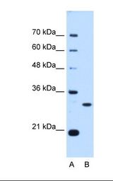 PSME3 Antibody - Lane A: Marker. Lane B: HepG2 cell lysate. Antibody concentration: 0.25 ug/ml. Gel concentration: 12%.  This image was taken for the unconjugated form of this product. Other forms have not been tested.