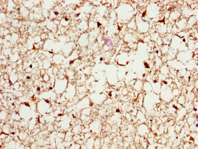 PSME3 Antibody - IHC image of PSME3 Antibody diluted at 1:200 and staining in paraffin-embedded human brain tissue performed on a Leica BondTM system. After dewaxing and hydration, antigen retrieval was mediated by high pressure in a citrate buffer (pH 6.0). Section was blocked with 10% normal goat serum 30min at RT. Then primary antibody (1% BSA) was incubated at 4°C overnight. The primary is detected by a biotinylated secondary antibody and visualized using an HRP conjugated SP system.