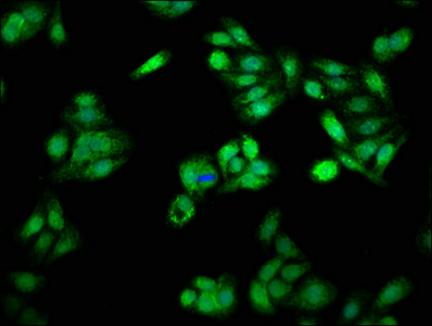 PSME3 Antibody - Immunofluorescence staining of HepG2 cells with PSME3 Antibody at 1:66, counter-stained with DAPI. The cells were fixed in 4% formaldehyde, permeabilized using 0.2% Triton X-100 and blocked in 10% normal Goat Serum. The cells were then incubated with the antibody overnight at 4°C. The secondary antibody was Alexa Fluor 488-congugated AffiniPure Goat Anti-Rabbit IgG(H+L).