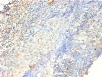 PSME3 Antibody - Immunohistochemistry of paraffin-embedded human tonsil tissue using PSME3 Antibody at dilution of 1:100