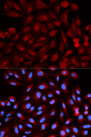 PSME3 Antibody - Immunofluorescence analysis of HeLa cells using PSME3 antibody. Blue: DAPI for nuclear staining.