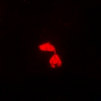 PSME3 Antibody - Immunofluorescent analysis of PA28 gamma staining in HeLa cells. Formalin-fixed cells were permeabilized with 0.1% Triton X-100 in TBS for 5-10 minutes and blocked with 3% BSA-PBS for 30 minutes at room temperature. Cells were probed with the primary antibody in 3% BSA-PBS and incubated overnight at 4 deg C in a humidified chamber. Cells were washed with PBST and incubated with a DyLight 594-conjugated secondary antibody (red) in PBS at room temperature in the dark.