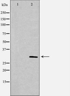 PSME3 Antibody - Western blot analysis of HeLa whole cells lysates using PSME3 antibody. The lane on the left is treated with the antigen-specific peptide.
