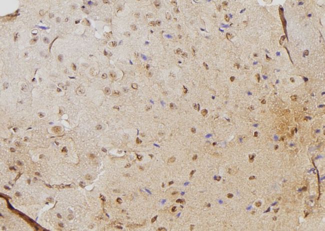PSME3 Antibody - 1:100 staining mouse brain tissue by IHC-P. The sample was formaldehyde fixed and a heat mediated antigen retrieval step in citrate buffer was performed. The sample was then blocked and incubated with the antibody for 1.5 hours at 22°C. An HRP conjugated goat anti-rabbit antibody was used as the secondary.