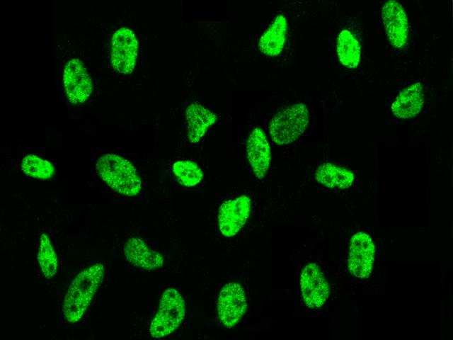 PSME3 Antibody - Immunofluorescence staining of PSME3 in HeLa cells. Cells were fixed with 4% PFA, permeabilzed with 0.1% Triton X-100 in PBS, blocked with 10% serum, and incubated with rabbit anti-human PSME3 polyclonal antibody (dilution ratio 1:300) at 4°C overnight. Then cells were stained with the Alexa Fluor 488-conjugated Goat Anti-rabbit IgG secondary antibody (green). Positive staining was localized to nucleus.