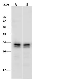 PSME3 Antibody - Anti-PSME3 rabbit polyclonal antibody at 1:500 dilution. Lane A: Jurkat Whole Cell Lysate. Lane B: HepG2 Whole Cell Lysate. Lysates/proteins at 30 ug per lane. Secondary: Goat Anti-Rabbit IgG (H+L)/HRP at 1/10000 dilution. Developed using the ECL technique. Performed under reducing conditions. Predicted band size: 29 kDa. Observed band size: 30 kDa.
