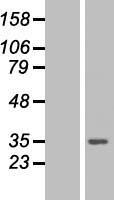 PSME3 Protein - Western validation with an anti-DDK antibody * L: Control HEK293 lysate R: Over-expression lysate