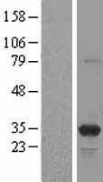 PSME3 Protein - Western validation with an anti-DDK antibody * L: Control HEK293 lysate R: Over-expression lysate