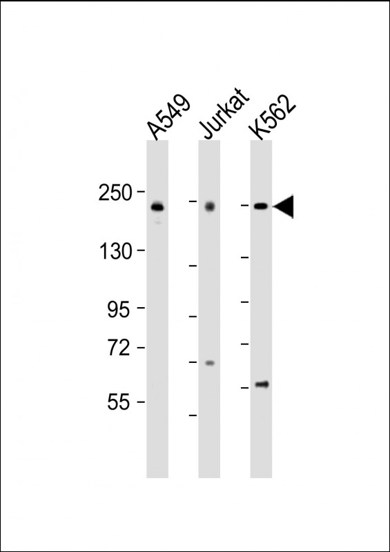 PSME4 / PA200 Antibody - All lanes: Anti-PSME4 Antibody (N-Term) at 1:2000 dilution. Lane 1: A549 whole cell lysate. Lane 2: Jurkat whole cell lysate. Lane 3: K562 whole cell lysate Lysates/proteins at 20 ug per lane. Secondary Goat Anti-Rabbit IgG, (H+L), Peroxidase conjugated at 1:10000 dilution. Predicted band size: 211 kDa. Blocking/Dilution buffer: 5% NFDM/TBST.