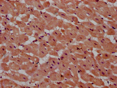 PSME4 / PA200 Antibody - Immunohistochemistry Dilution at 1:600 and staining in paraffin-embedded human heart tissue performed on a Leica BondTM system. After dewaxing and hydration, antigen retrieval was mediated by high pressure in a citrate buffer (pH 6.0). Section was blocked with 10% normal Goat serum 30min at RT. Then primary antibody (1% BSA) was incubated at 4°C overnight. The primary is detected by a biotinylated Secondary antibody and visualized using an HRP conjugated SP system.