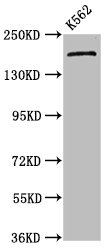 PSME4 / PA200 Antibody - Western Blot Positive WB detected in: K562 whole cell lysate All Lanes: PSME4 antibody at 4.5µg/ml Secondary Goat polyclonal to rabbit IgG at 1/50000 dilution Predicted band size: 212, 140, 114, 25 KDa Observed band size: 212 KDa