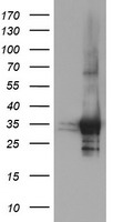 PSMF1 Antibody - HEK293T cells were transfected with the pCMV6-ENTRY control (Left lane) or pCMV6-ENTRY PSMF1 (Right lane) cDNA for 48 hrs and lysed. Equivalent amounts of cell lysates (5 ug per lane) were separated by SDS-PAGE and immunoblotted with anti-PSMF1.