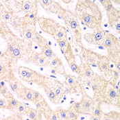 PSMF1 Antibody - Immunohistochemistry of paraffin-embedded human liver injury tissue.
