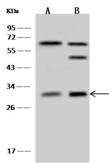 PSMF1 Antibody - Anti-PSMF1 rabbit polyclonal antibody at 1:500 dilution. Lane A: 293T Whole Cell Lysate. Lane B: HeLa Whole Cell Lysate. Lysates/proteins at 30 ug per lane. Secondary: Goat Anti-Rabbit IgG (H+L)/HRP at 1/10000 dilution. Developed using the ECL technique. Performed under reducing conditions. Predicted band size: 30 kDa. Observed band size: 30 kDa.