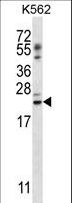 PSORS1C1 Antibody - PSORS1C1 Antibody western blot of K562 cell line lysates (35 ug/lane). The PSORS1C1 antibody detected the PSORS1C1 protein (arrow).