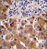 PSORS1C1 Antibody - PSORS1C1 Antibody immunohistochemistry of formalin-fixed and paraffin-embedded human liver tissue followed by peroxidase-conjugated secondary antibody and DAB staining.