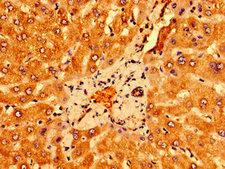 PSORS1C1 Antibody - Immunohistochemistry image of paraffin-embedded human liver tissue at a dilution of 1:100