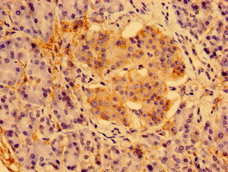 PSORS1C1 Antibody - Immunohistochemistry image of paraffin-embedded human pancreatic tissue at a dilution of 1:100