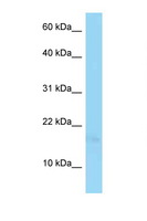 PSORS1C1 Antibody - PSORS1C1 antibody Western blot of Jurkat Cell lysate. Antibody concentration 1 ug/ml.  This image was taken for the unconjugated form of this product. Other forms have not been tested.