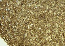 PSPC1 Antibody - 1:100 staining mouse pancreas tissue by IHC-P. The sample was formaldehyde fixed and a heat mediated antigen retrieval step in citrate buffer was performed. The sample was then blocked and incubated with the antibody for 1.5 hours at 22°C. An HRP conjugated goat anti-rabbit antibody was used as the secondary.