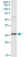 PSPH Antibody - PSPH monoclonal antibody (M01), clone 3A5. Western Blot analysis of PSPH expression in human placenta.