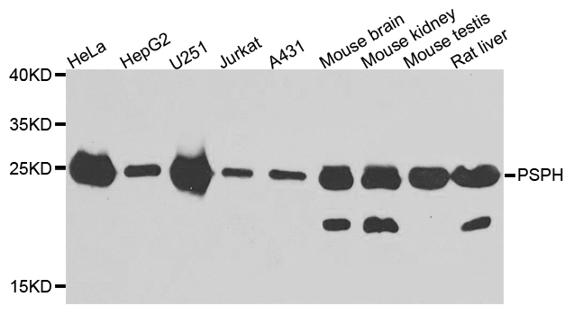 PSPH Antibody - Western blot analysis of extracts of various cell lines.