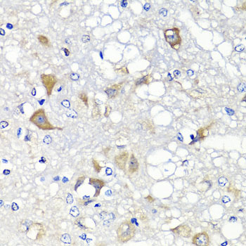 PSPH Antibody - Immunohistochemistry of paraffin-embedded rat brain tissue.
