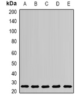 PSPH Antibody - Western blot analysis of PSPH expression in Jurkat (A); A431 (B); mouse brain (C); mouse kidney (D); rat liver (E) whole cell lysates.