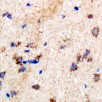 PSPH Antibody - Immunohistochemical analysis of PSPH staining in rat brain formalin fixed paraffin embedded tissue section. The section was pre-treated using heat mediated antigen retrieval with sodium citrate buffer (pH 6.0). The section was then incubated with the antibody at room temperature and detected using an HRP conjugated compact polymer system. DAB was used as the chromogen. The section was then counterstained with hematoxylin and mounted with DPX.