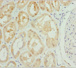 PSPH Antibody - Immunohistochemistry of paraffin-embedded human kidney tissue at dilution 1:100
