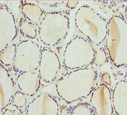 PSPH Antibody - Immunohistochemistry of paraffin-embedded human thyroid tissue at dilution 1:100