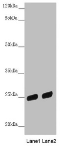 PSPH Antibody - Western blot All Lanes: PSPH antibody at 3.81 ug/ml Lane 1: HL60 whole cell lysate Lane 2: A431 whole cell lysate Secondary Goat polyclonal to rabbit IgG at 1/10000 dilution Predicted band size: 25 kDa Observed band size: 25 kDa