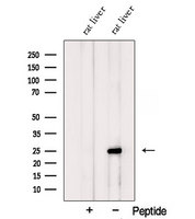 PSPH Antibody - Western blot analysis of extracts of HepG2 cells using PSPH antibody. The lane on the left was treated with blocking peptide.