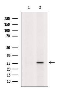 PSPH Antibody