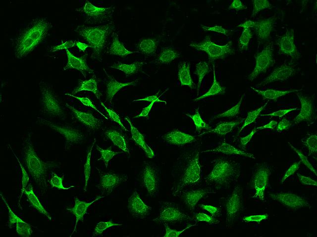 PSPH Antibody - Immunofluorescence staining of PSPH in Hela cells. Cells were fixed with 4% PFA, permeabilzed with 0.1% Triton X-100 in PBS, blocked with 10% serum, and incubated with rabbit anti-Human PSPH polyclonal antibody (dilution ratio 1:200) at 4°C overnight. Then cells were stained with the Alexa Fluor 488-conjugated Goat Anti-rabbit IgG secondary antibody (green). Positive staining was localized to Cytoplasm.