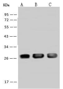 PSPH Antibody - Anti-PSPH rabbit polyclonal antibody at 1:500 dilution. Lane A: MCF7 Whole Cell Lysate. Lane B: K-562 Whole Cell Lysate. Lane C: Hep G2 Whole Cell Lysate. Lysates/proteins at 30 ug per lane. Secondary: Goat Anti-Rabbit IgG (H+L)/HRP at 1/10000 dilution. Developed using the ECL technique. Performed under reducing conditions. Predicted band size: 25 kDa. Observed band size: 27 kDa.
