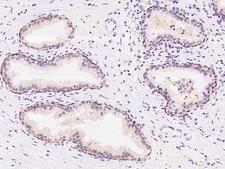 PSPH Antibody - Immunochemical staining of human PSPH in human prostate with rabbit polyclonal antibody at 1:3000 dilution, formalin-fixed paraffin embedded sections.